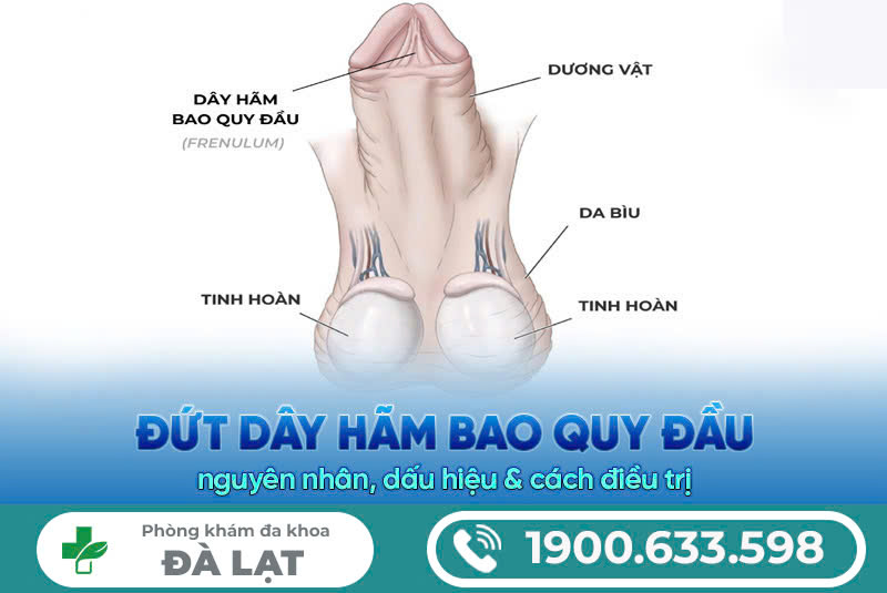 ĐỨT DÂY HÃM QUY ĐẦU CÓ SAO KHÔNG